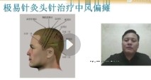刘朝龙极易针灸视频课程10集【网盘资源】